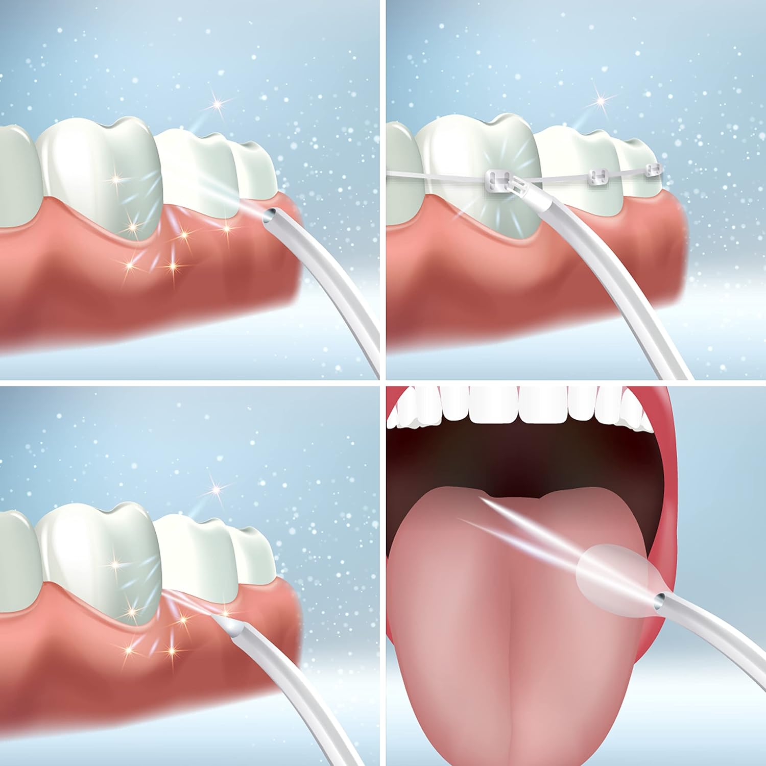 Irrigador Dental Ultrasónico - BioSmile® (Incluye 4 Cabezales)